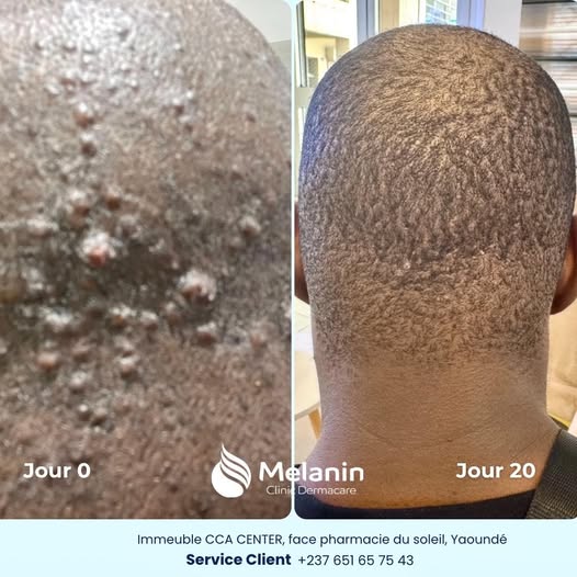 Jour 0 → Jour 90